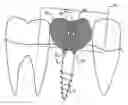 Fig. 01 - Blank and method for producing a dental prosthesis