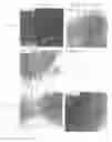 Fig. 05 - (+)-TRANS-4-(1-AMINOETHYL)-1-(4-PYRIDYCARBAMOYL)-CYCLOHEXANE AND METHOD FOR PROMOTING NEURAL GROWTH IN THE CENTRAL NERVOUS SYSTEM AND IN A PATIENT AT A SITE OF NEURONAL LESION