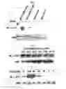 Fig. 04 - Ddr2 protein with activated kinase activity and preparation method thereof