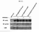 Fig. 09 - Ddr2 protein with activated kinase activity and preparation method thereof