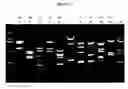 Fig. 03 - PCR based capsular typing method
