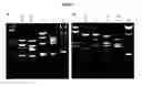 Fig. 04 - PCR based capsular typing method