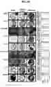 Fig. 12 - Molecular profiling of cancer