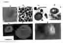 Fig. 02 - Methods for detecting misfolded proteins in biological samples