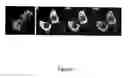 Fig. 04 - Methods for identifying compounds interacting with small membrane-bound gtp-ases