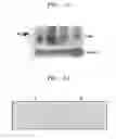 Fig. 11 - BREAST CANCER RELATED PROTEIN, GENE ENCODING THE SAME, AND METHOD OF DIAGNOSING BREAST CANCER USING THE PROTEIN AND GENE