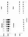 Fig. 11 - Pknb kinase and pstp phosphatase and methods of identifying inhibitory substances
