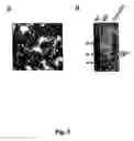 Fig. 06 - Chimeric empty capsids of the infectious bursal disease viruse (ibdv), obtainment process and applications
