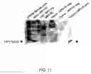 Fig. 12 - Systems of diagnosing cervical cancer