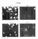 Fig. 05 - Selective culture method and isolation method of small hepatocytes with hialuronic acid