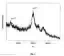 Fig. 07 - METHOD AND APPARATUS FOR MASS SPECTROMETRIC IMMUNOASSAY ANALYSIS OF SPECIFIC BIOLOGICAL FLUID PROTEINS