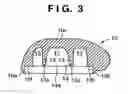 Fig. 04 - Golf club head