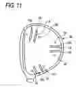 Fig. 07 - Golf club head