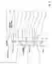 Fig. 05 - Method for increasing the spontaneity of overlapping shifting operations in an automatic transmission