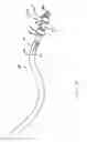 Fig. 07 - Dissolution of arterial cholesterol plaques by pharmacological preparation