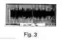 Fig. 04 - PROCESSES FOR PREPARING NOVEL METHYLENE BLUE DERIVATIVE