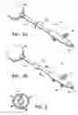 Fig. 07 - Treatment of a body cavity