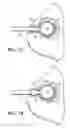 Fig. 08 - Treatment of a body cavity