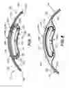Fig. 06 - Implantable direct cardiac compression device and system