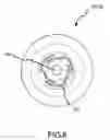 Fig. 09 - Implantable hearing aid transducer