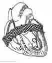 Fig. 01 - Method and apparatus for external stabilization of the heart