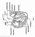 Fig. 02 - Method and apparatus for external stabilization of the heart