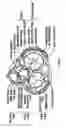 Fig. 03 - Method and apparatus for external stabilization of the heart