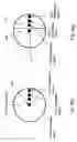 Fig. 09 - Apparatus for recognizing abnormal tissue using the detection of early increase in microvascular blood content