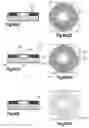 Fig. 06 - Intraocular pressure measurement system including a sensor mounted in a contact lens