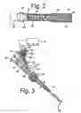 Fig. 03 - Regional anesthetic method and apparatus