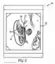 Fig. 03 - Ablation array having independently activated ablation elements