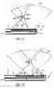 Fig. 11 - Ablation array having independently activated ablation elements