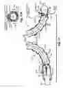 Fig. 12 - Biomedical positioning and stabilization system