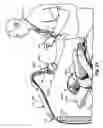 Fig. 20 - Biomedical positioning and stabilization system