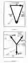Fig. 06 - Methods and analysis for cardiac ischemia detection