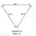 Fig. 04 - Differentiating ischemic from non-ischemic T-wave inversion