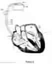 Fig. 07 - Method and system for heart failure status evaluation based on a disordered breathing index
