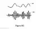 Fig. 13 - Method and system for heart failure status evaluation based on a disordered breathing index