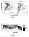Fig. 06 - BIOMORPHIC RHYTHMIC MOVEMENT CONTROLLER