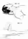 Fig. 10 - MYOFACIAL MASSAGER