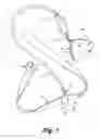 Fig. 02 - ADJUSTABLE SHOULDER ORTHOTIC