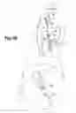 Fig. 05 - ADJUSTABLE SHOULDER ORTHOTIC