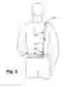 Fig. 08 - ADJUSTABLE SHOULDER ORTHOTIC