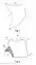 Fig. 02 - Anti-pronation device