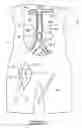 Fig. 08 - Bypass grafting system and apparatus