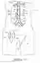 Fig. 17 - Bypass grafting system and apparatus