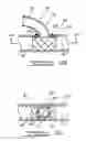 Fig. 21 - Bypass grafting system and apparatus