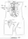 Fig. 22 - Bypass grafting system and apparatus
