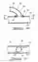 Fig. 24 - Bypass grafting system and apparatus