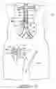 Fig. 27 - Bypass grafting system and apparatus